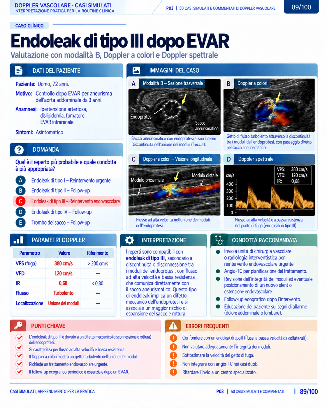 Pagina 89: Caso: endoleak di tipo III dopo EVAR. Anteprima in italiano del materiale di Doppler vascolare.