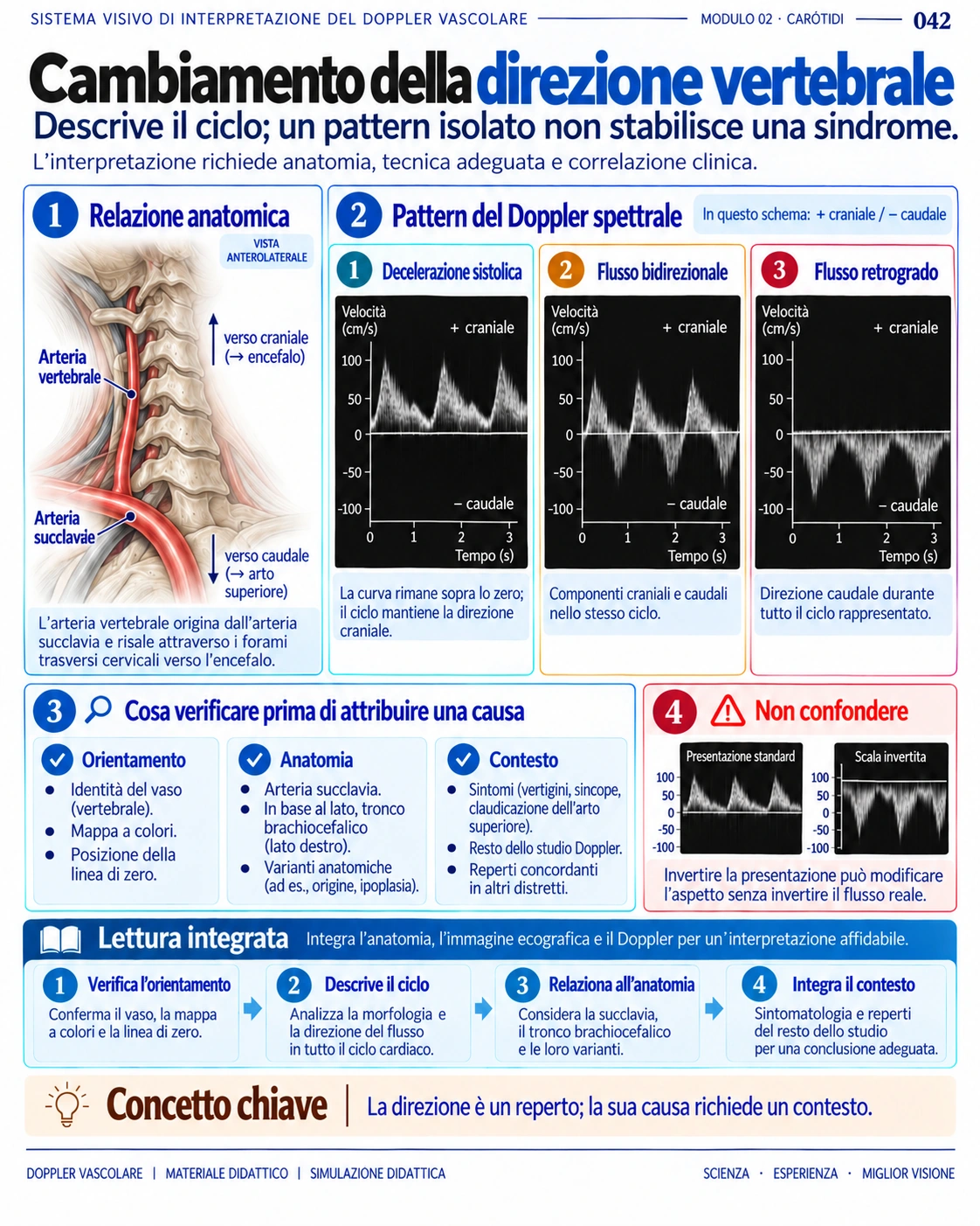 Pagina 42: Inversione del flusso vertebrale. Anteprima in italiano del materiale di Doppler vascolare.